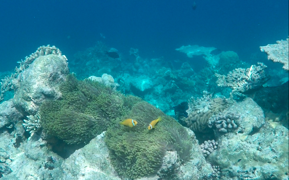 Park Hyatt Maldives Hadahaa  | Pool Villa & Water Villa