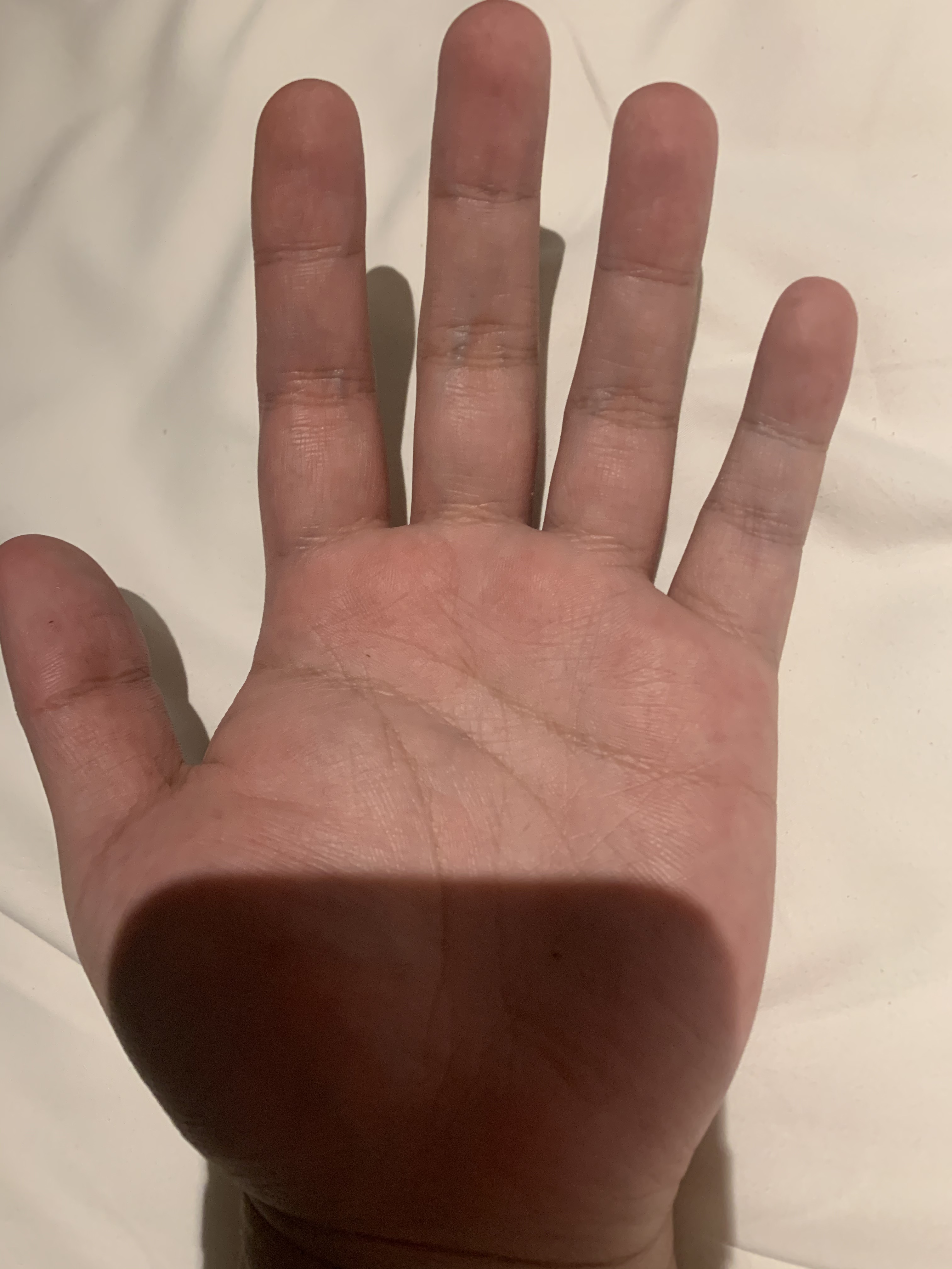 JW